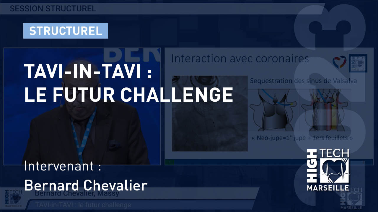 TAVI-in-TAVI : le futur challenge – Bernard Chevalier