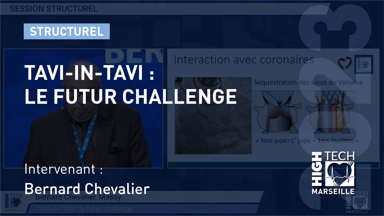 TAVI-in-TAVI : le futur challenge – Bernard Chevalier