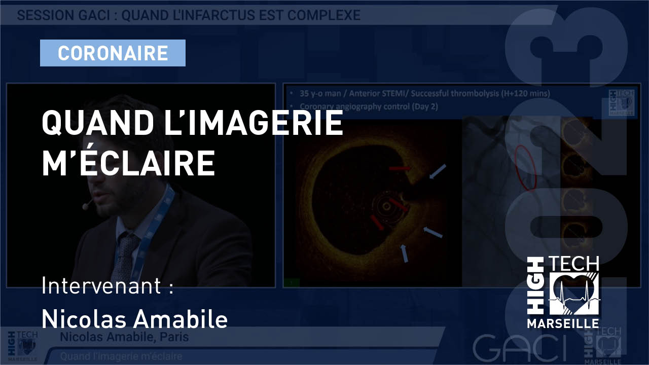 Quand l’imagerie m’éclaire –  Nicolas Amabile