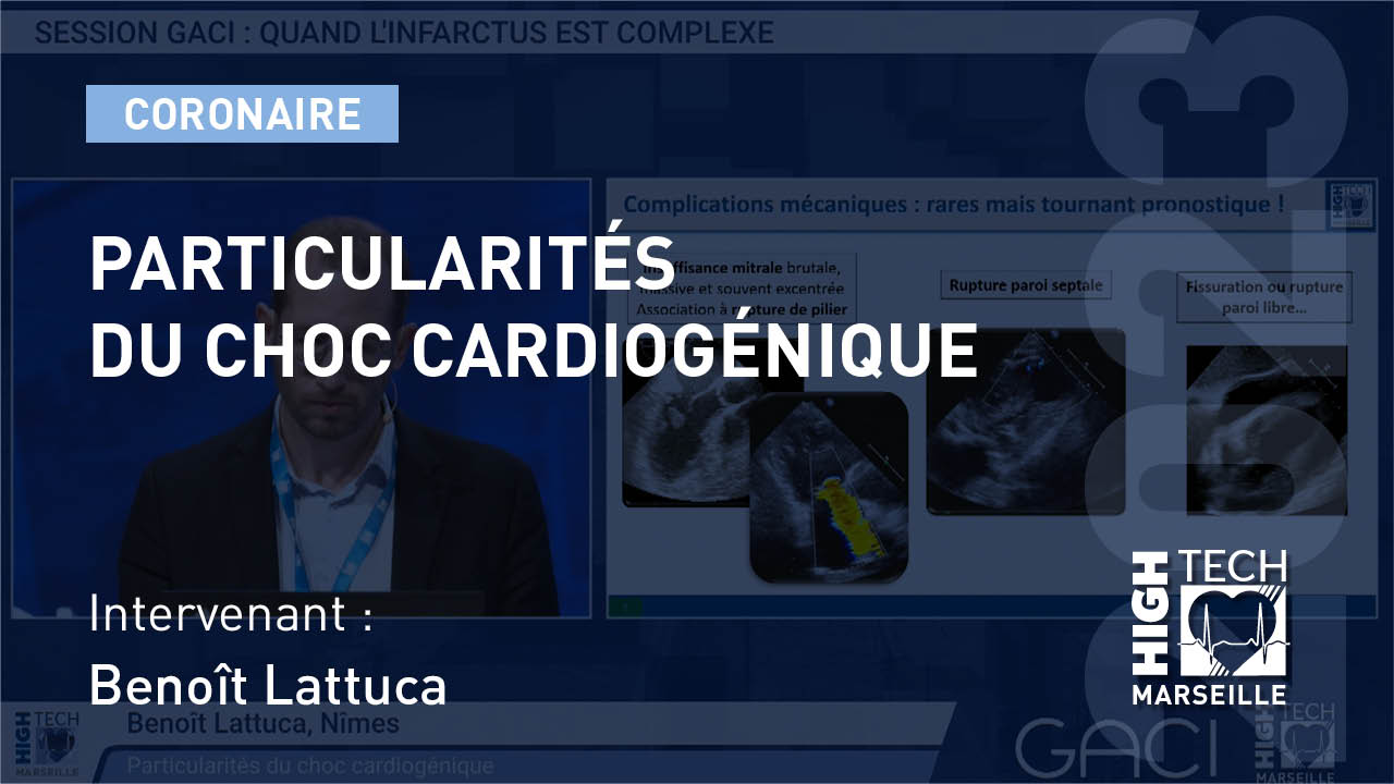 Particularités du choc cardiogénique –  Benoît Lattuca