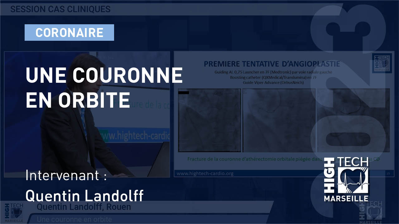 Une couronne en orbite –  Quentin Landolff