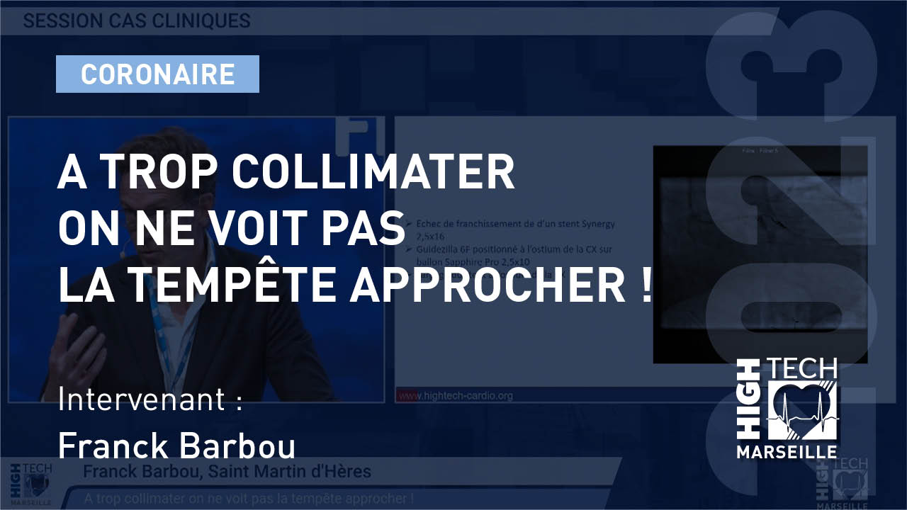 A trop collimater on ne voit pas la tempête approcher ! – Franck Barbou