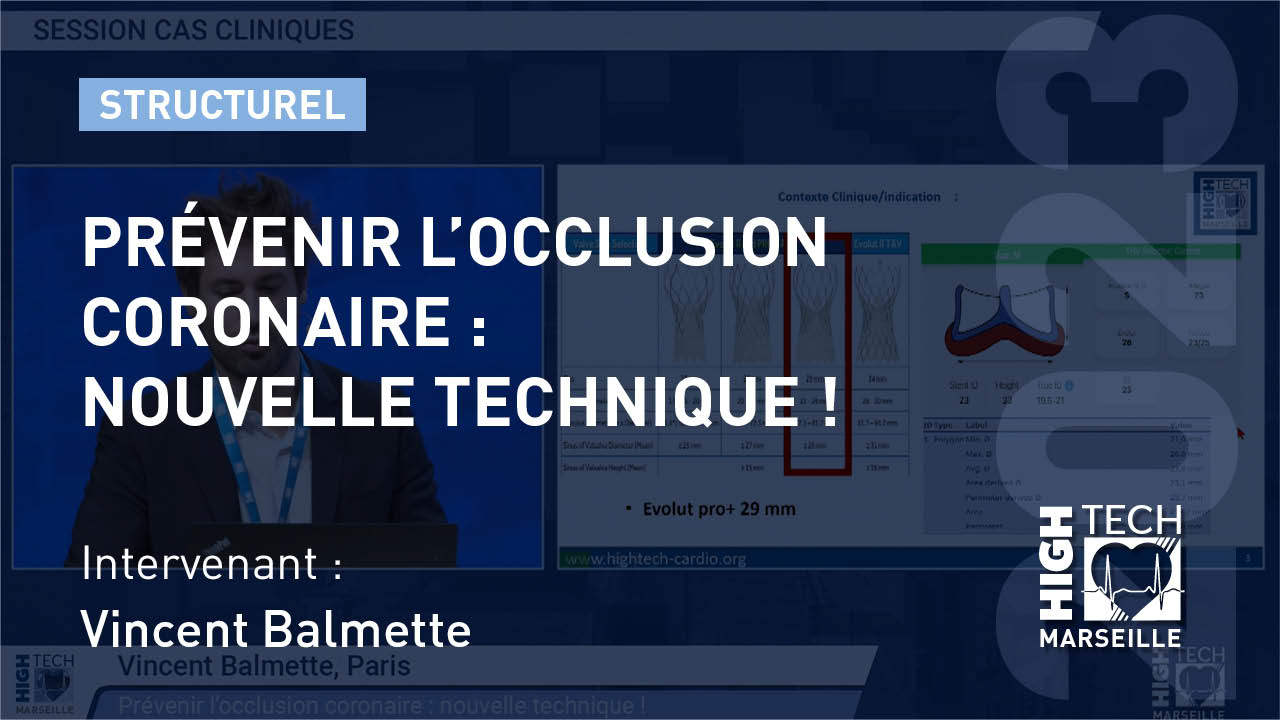 Prévenir l’occlusion coronaire : nouvelle technique !  – Vincent Balmette