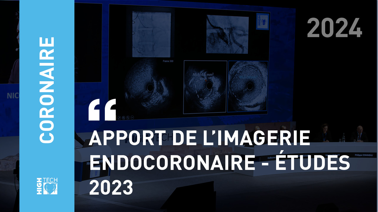 Apport de l’imagerie endocoronaire – études 2023 – Guillaume Cayla