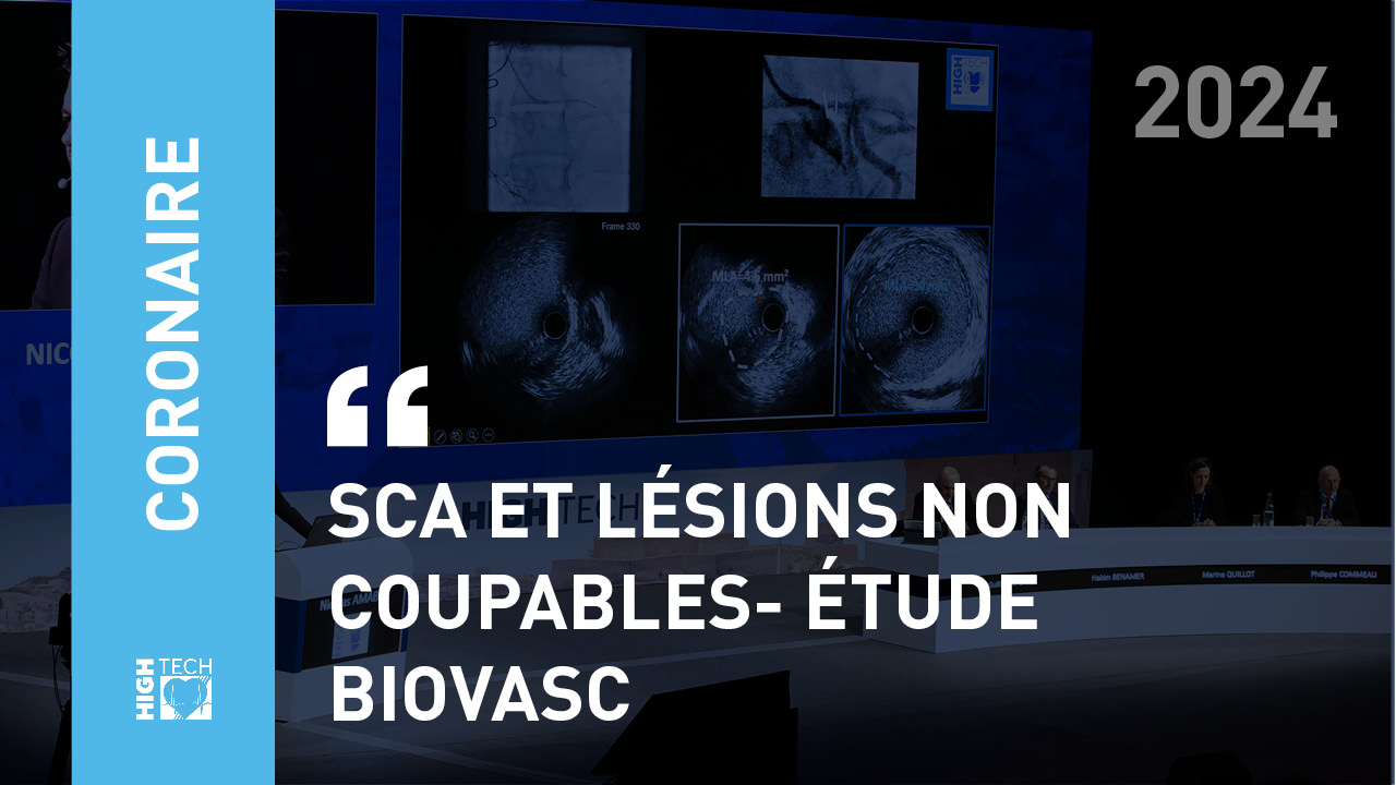 SCA et lésions non coupables- étude BIOVASC – Pascal Motreff