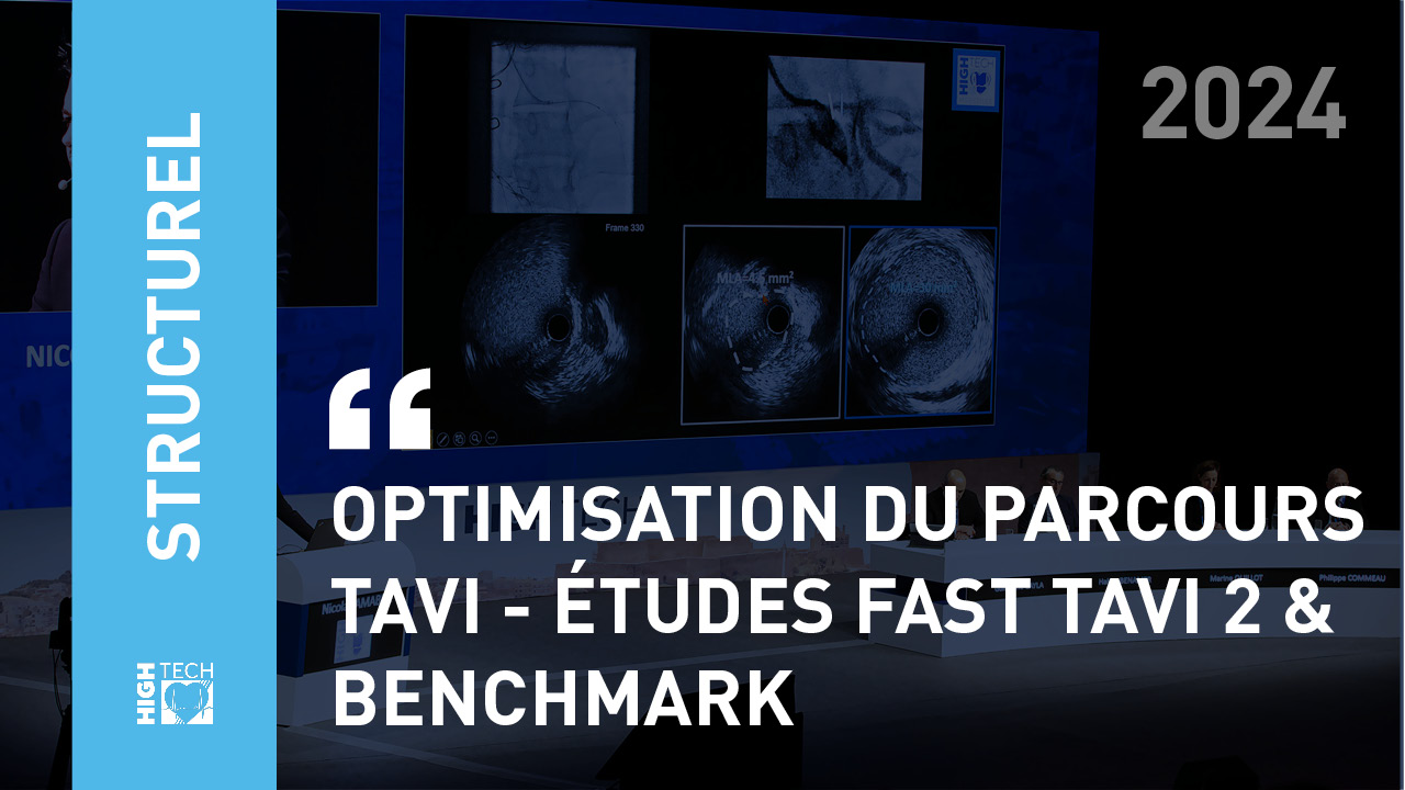 Optimisation du parcours TAVI – études FAST TAVI 2 & BENCHMARK – Flavien Vincent