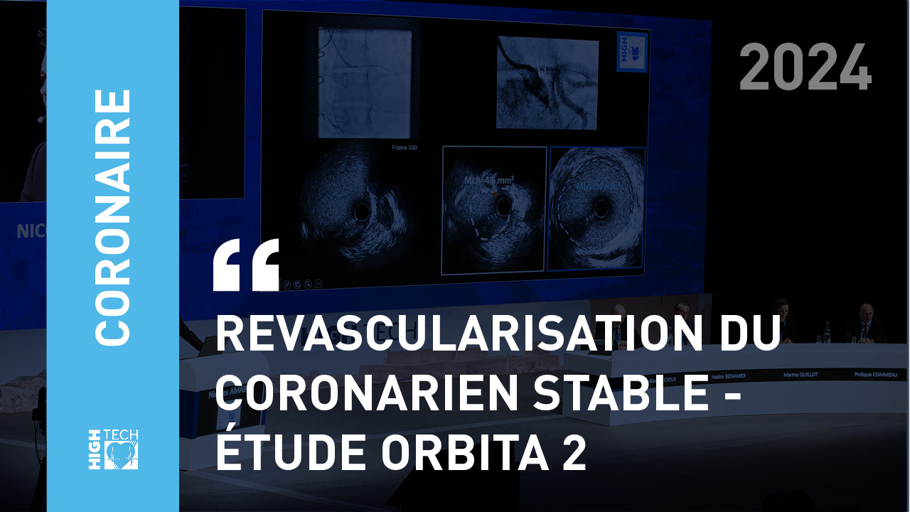 Revascularisation du coronarien stable – étude ORBITA 2 – Étienne Puymirat