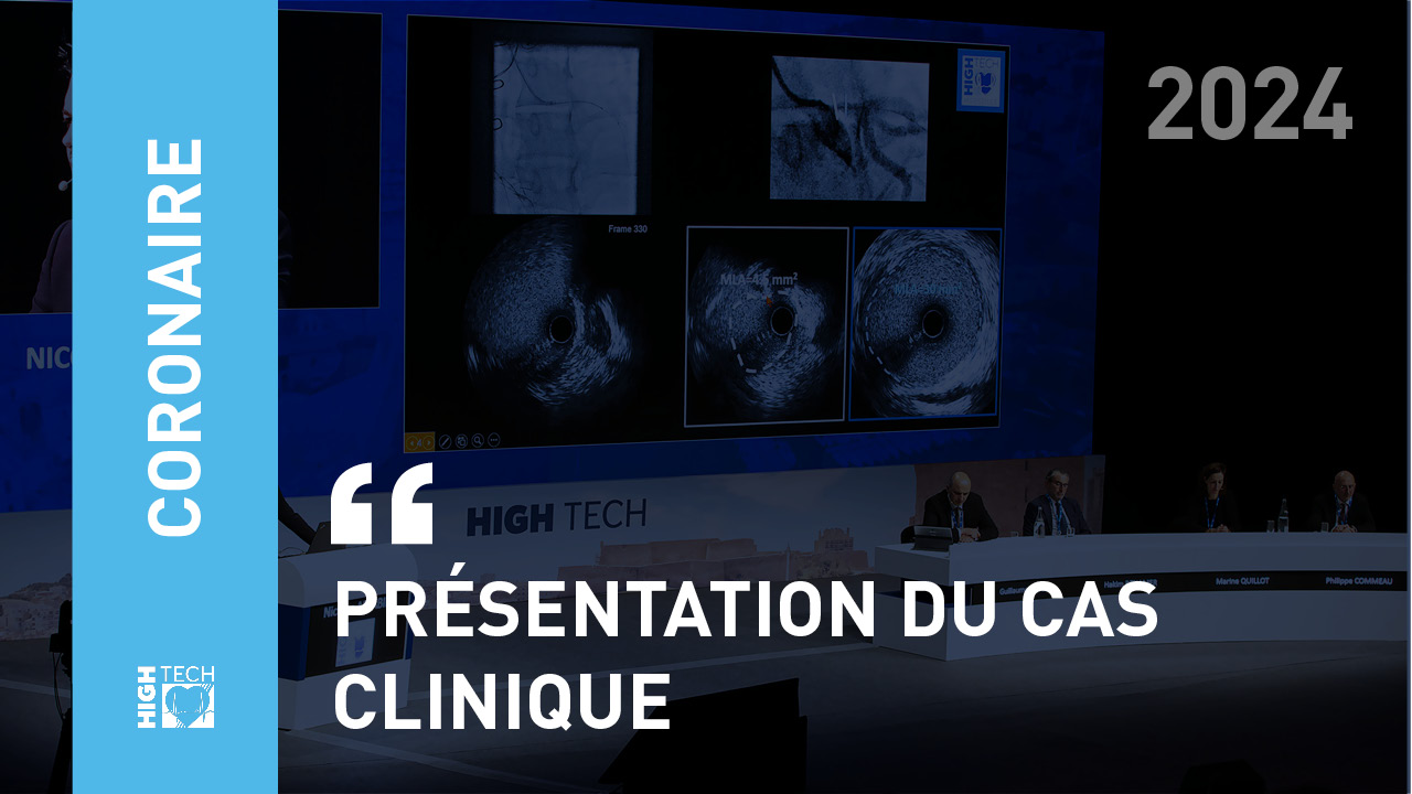 Présentation du cas clinique – Benjamin Honton