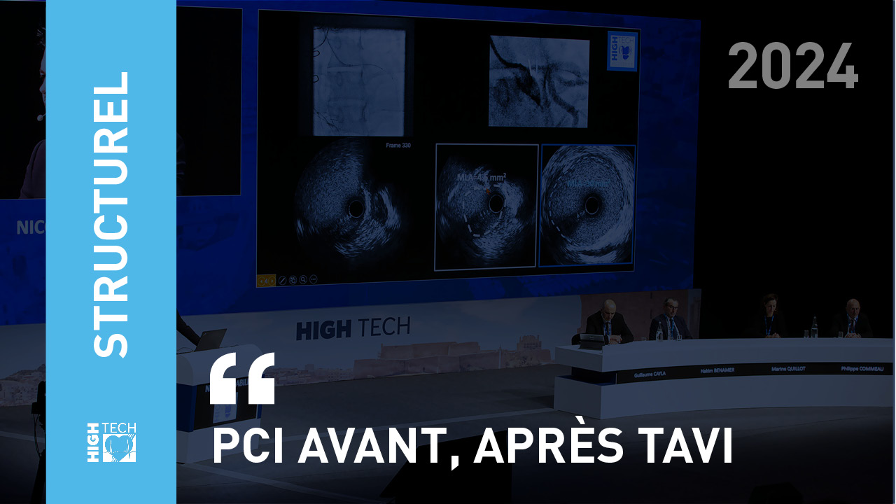 PCI avant, après TAVI – Thomas Cuisset