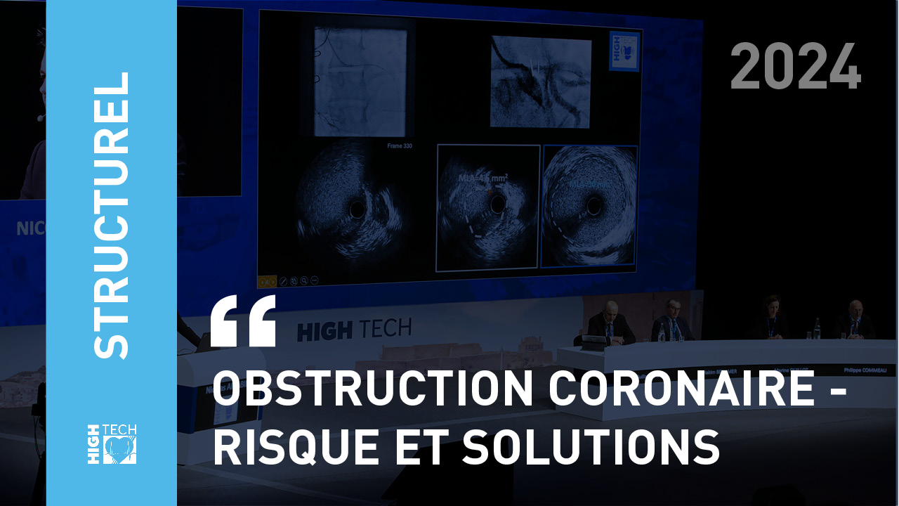 Obstruction coronaire – risque et solutions – Christophe Saint-Étienne
