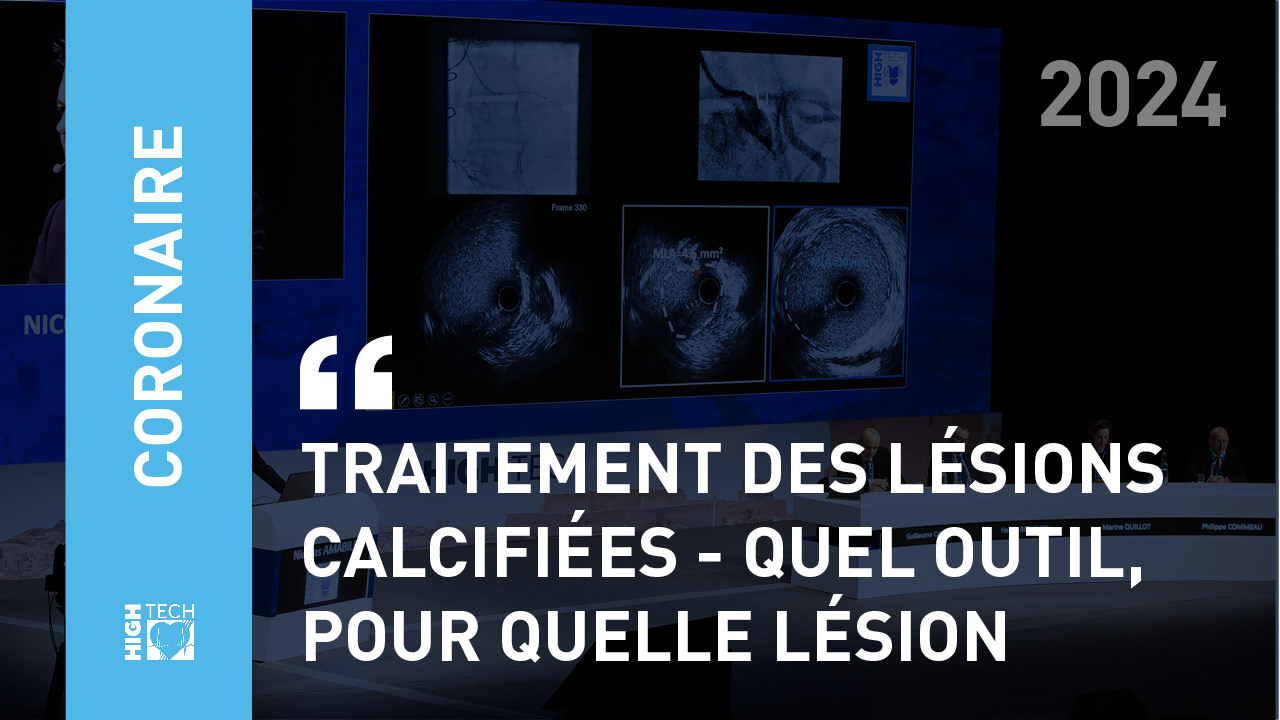 Traitement des lésions calcifiées – quel outil, pour quelle lésion – Brice Raul