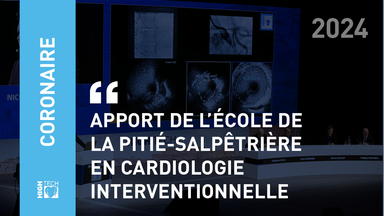 APPORT DE L’ÉCOLE DE LA PITIÉ-SALPÊTRIÈRE EN CARDIOLOGIE INTERVENTIONNELLE – Olivier Barthelemy, Farzin Beygui & Johane Silvain