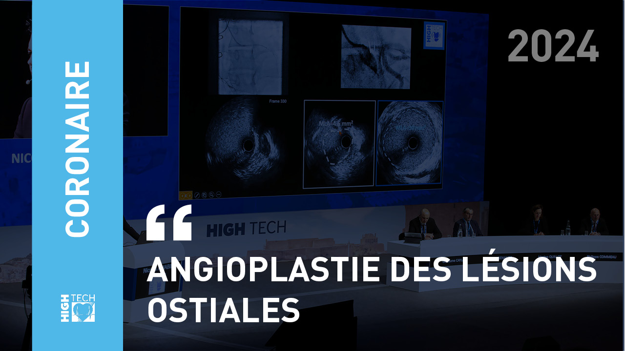 Angioplastie des lésions ostiales – Frédéric Bouisset