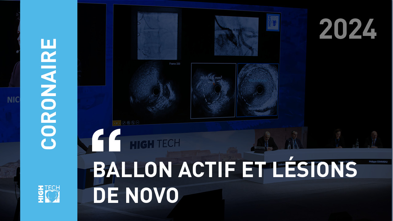 Ballon actif et lésions de novo – Nicolas Combaret