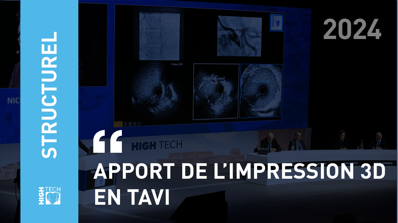 Apport de l’impression 3D en TAVI – Romain Didier