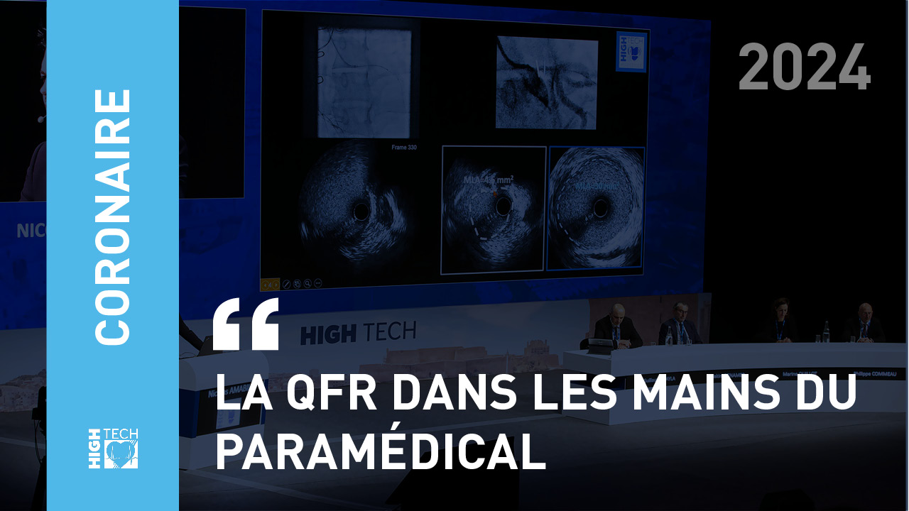 La QFR dans les mains du paramédical – Sofian Megres