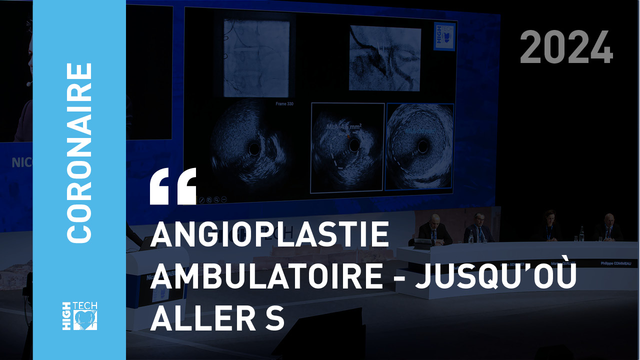 Angioplastie ambulatoire – jusqu’où aller – Romain Gallet