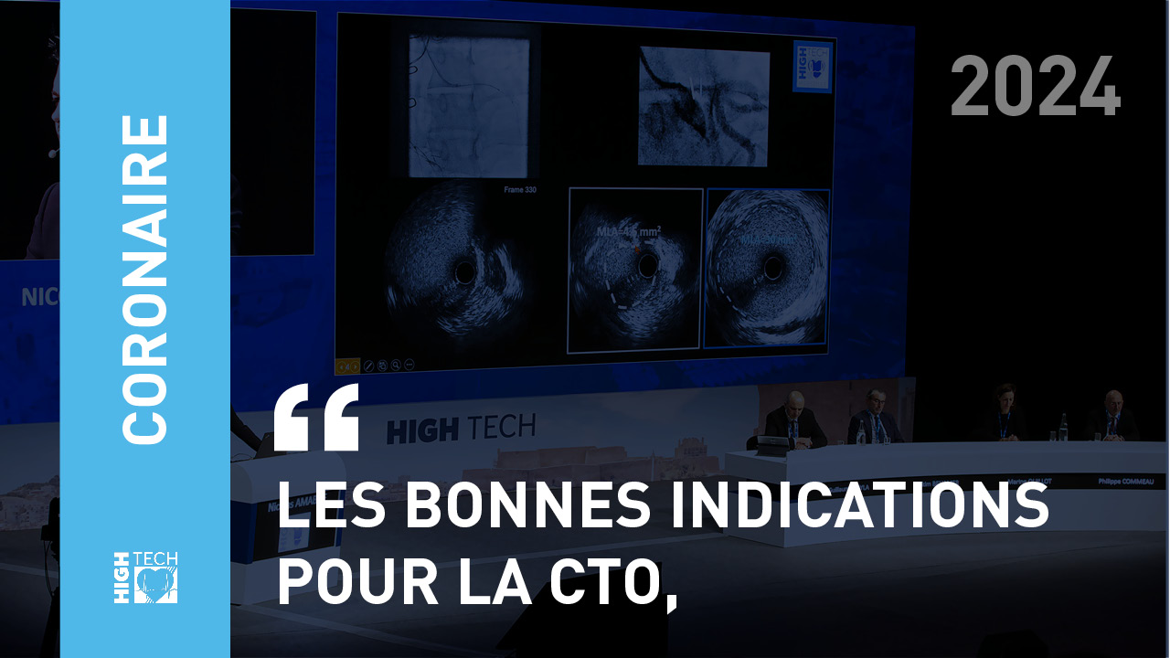 Les bonnes indications pour la CTO, – Pierre Deharo