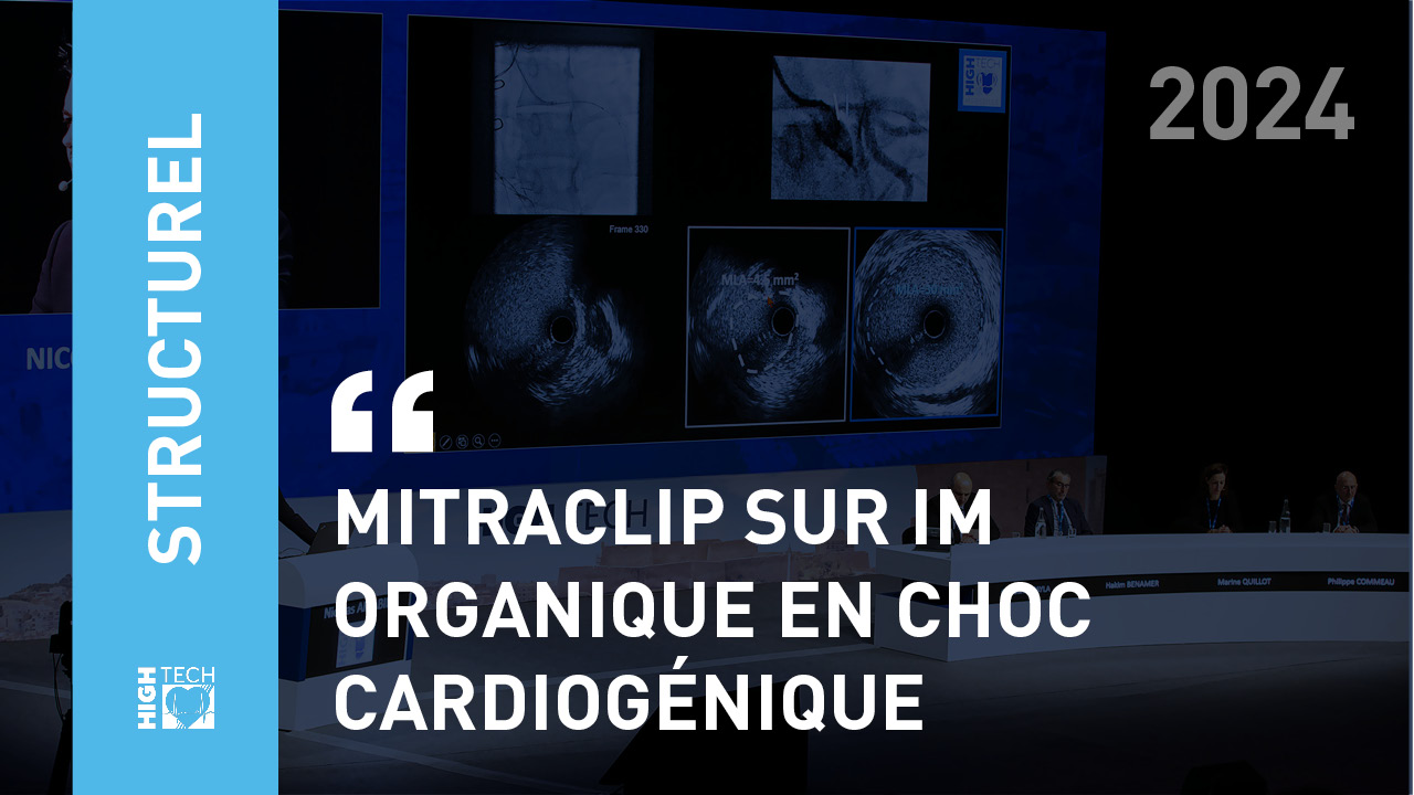 Mitraclip sur IM organique en choc cardiogénique – Paul-Émile Favre