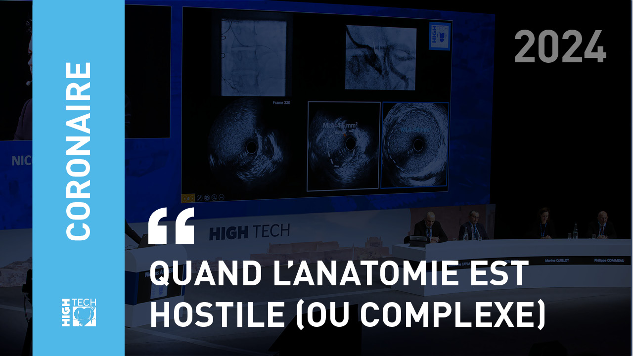 Quand l’anatomie est hostile (ou complexe) – Myriam Akodad