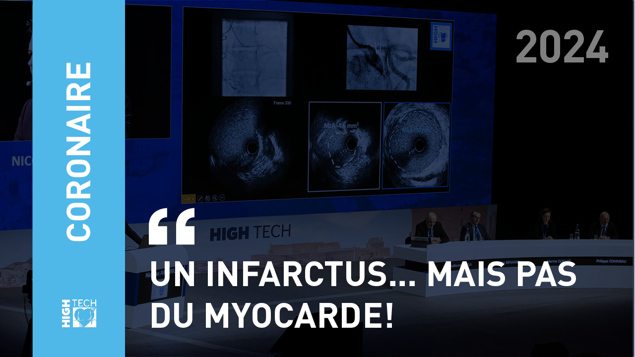 Un infarctus… mais pas du myocarde! – Pierre Robert