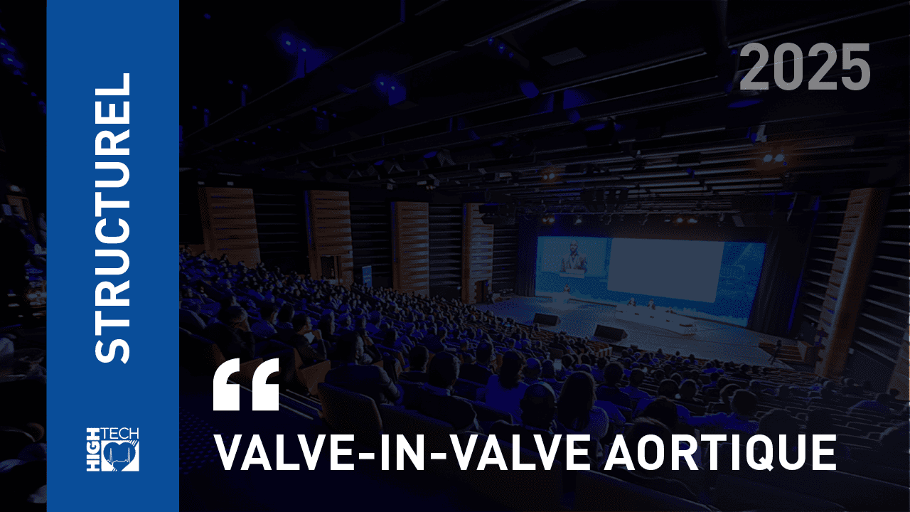 Valve-in-valve aortique – Thibaut Manigold