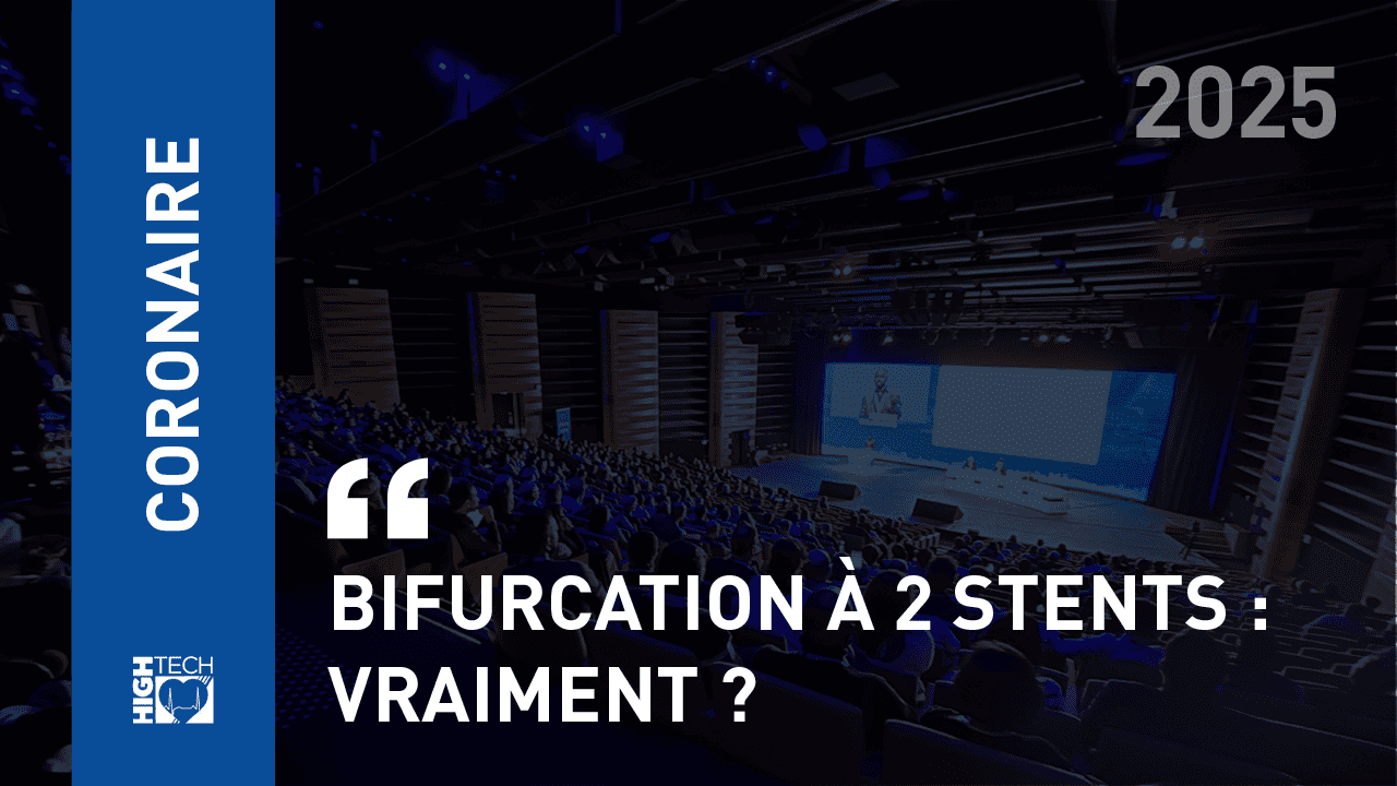 Bifurcation à 2 stents : Vraiment ? – Marion Chatot