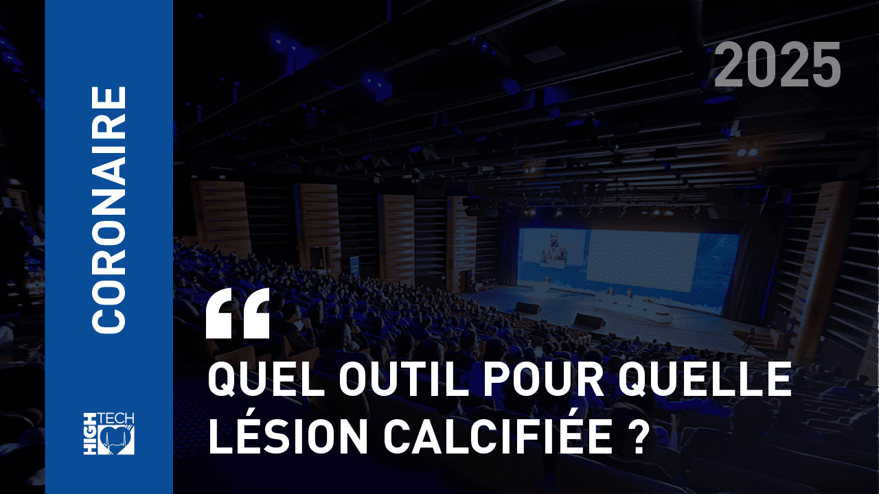 Quel outil pour quelle lésion calcifiée ? – Sébastien Levesque