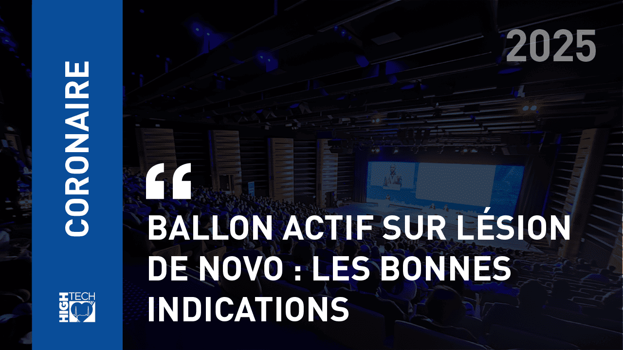 Ballon actif sur lésion de novo : Les bonnes indications – Eric Durand