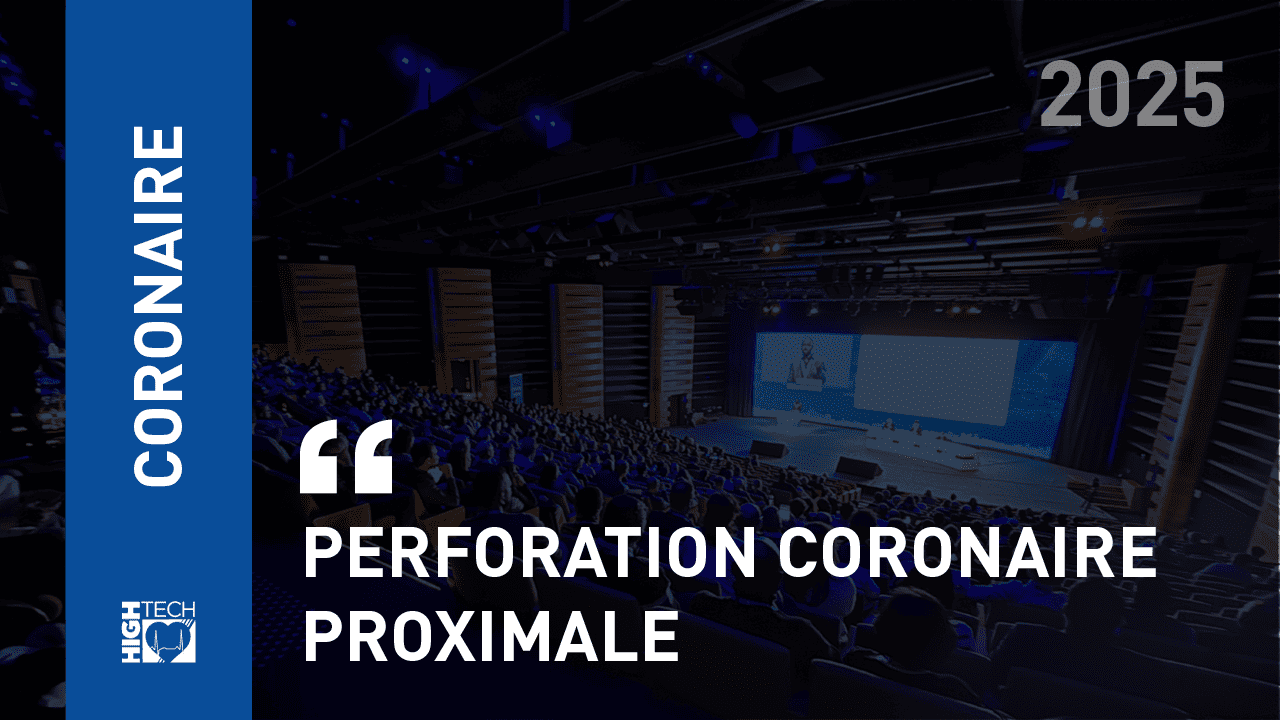 Perforation coronaire proximale – Laurent Drogoul