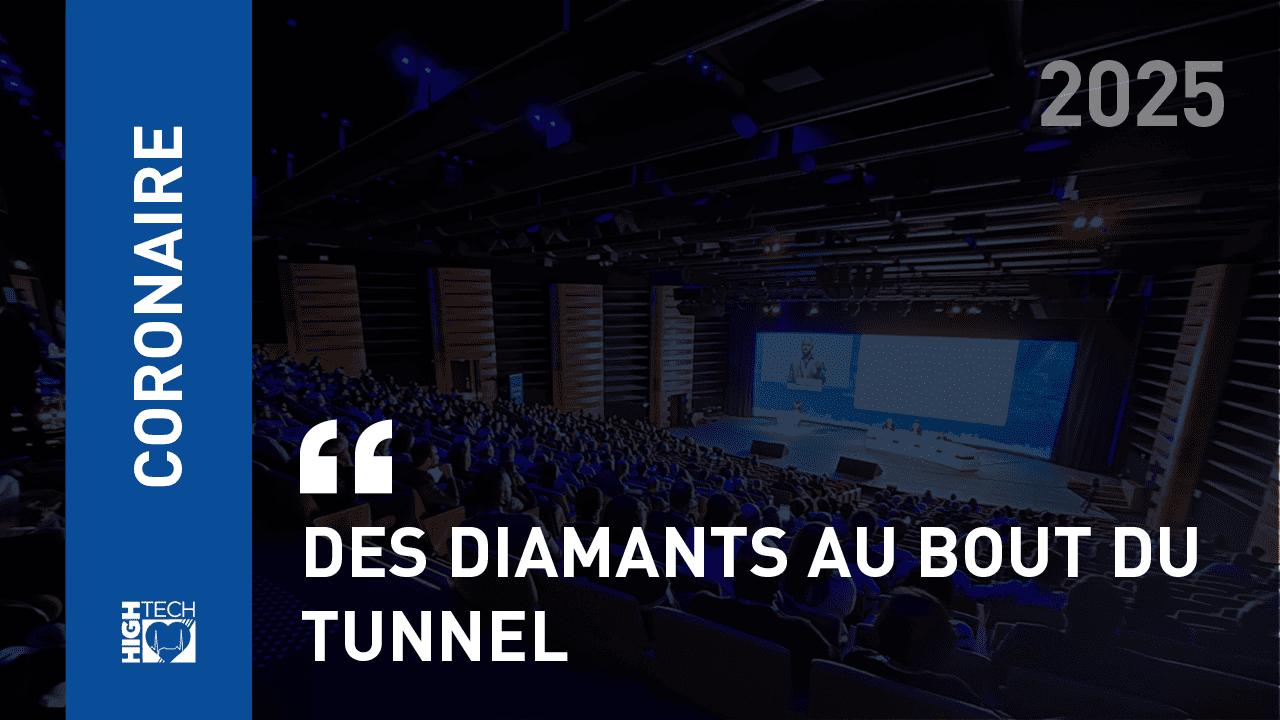 Des diamants au bout du tunnel – Pierre-Hugues Leboutte