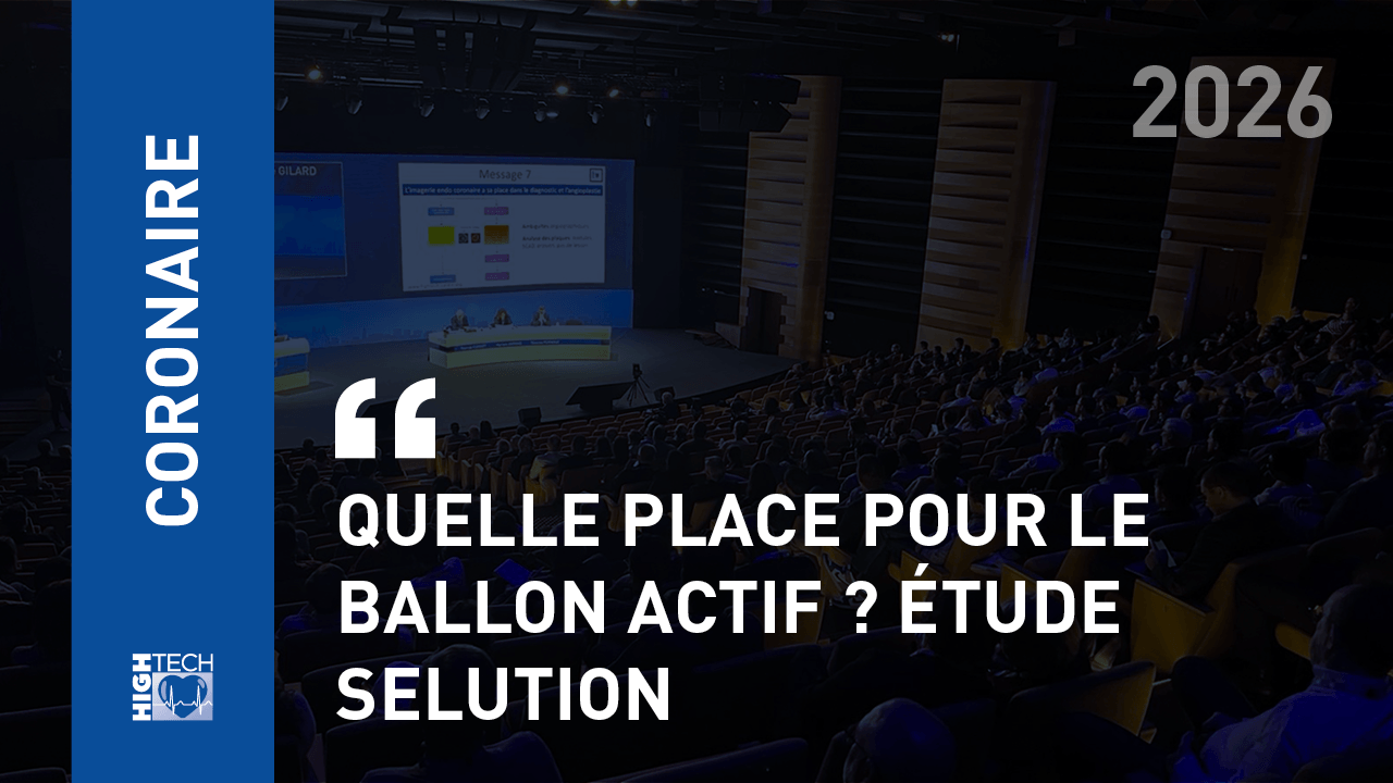Quelle place pour le ballon actif ? Étude SELUTION – Antoinette Neylon