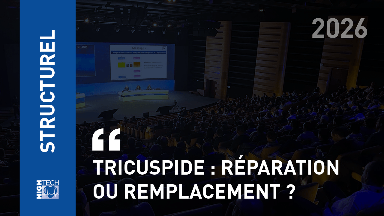 Tricuspide : réparation ou remplacement ? – Guillaume Leurent