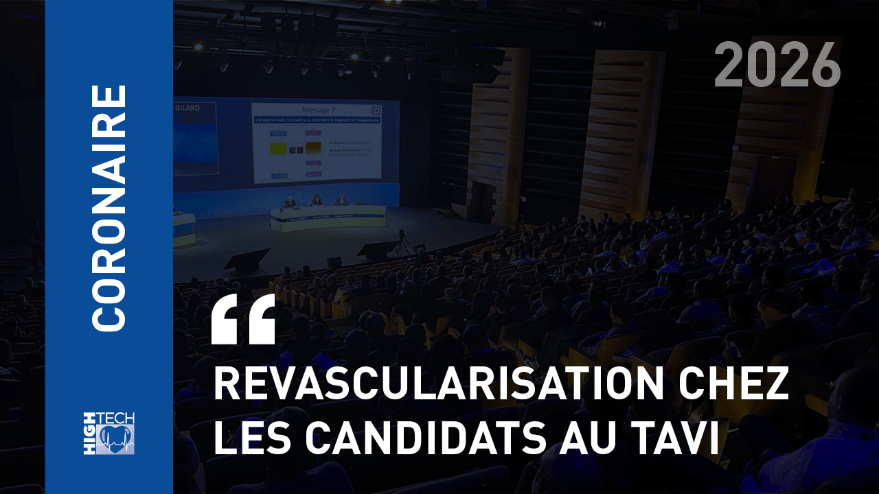 Revascularisation chez les candidats au TAVI – Cédric Delhaye