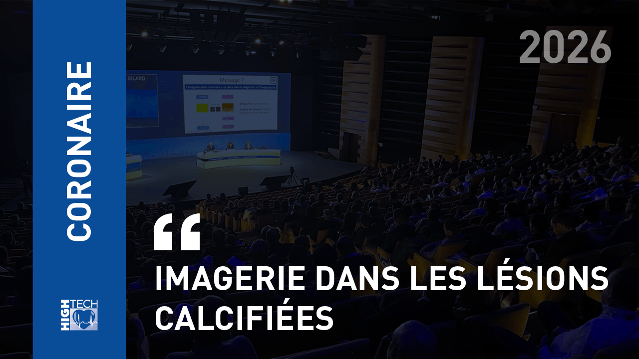 Imagerie dans les lésions calcifiées – Nicolas Combaret