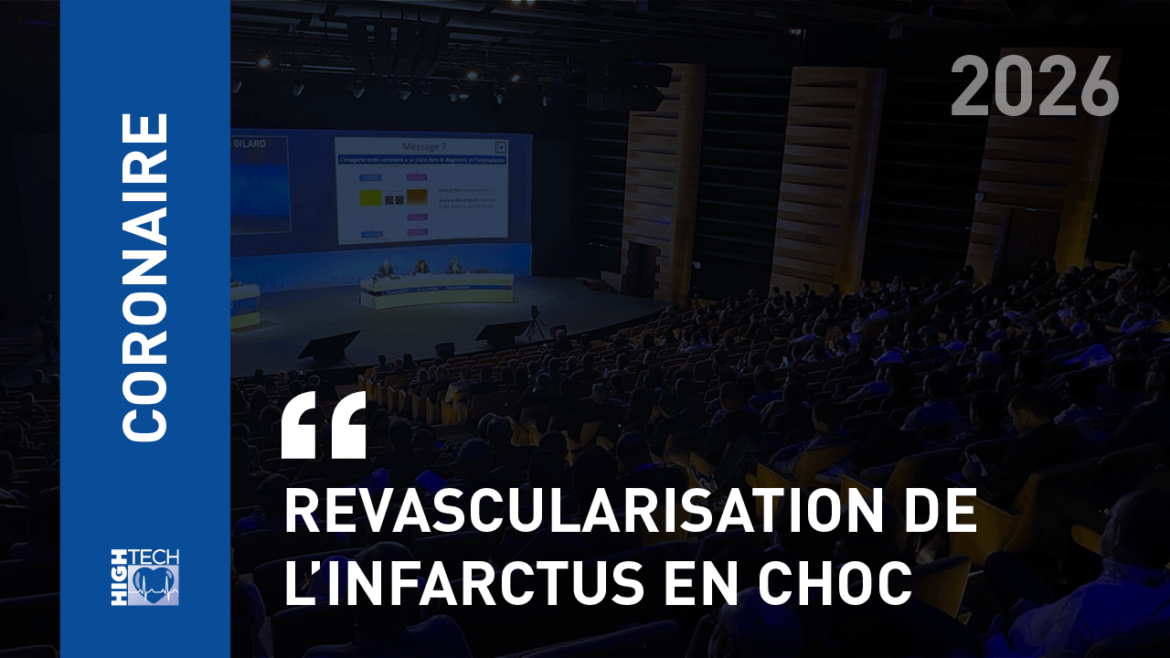 Revascularisation de l’infarctus en choc – Romain Didier