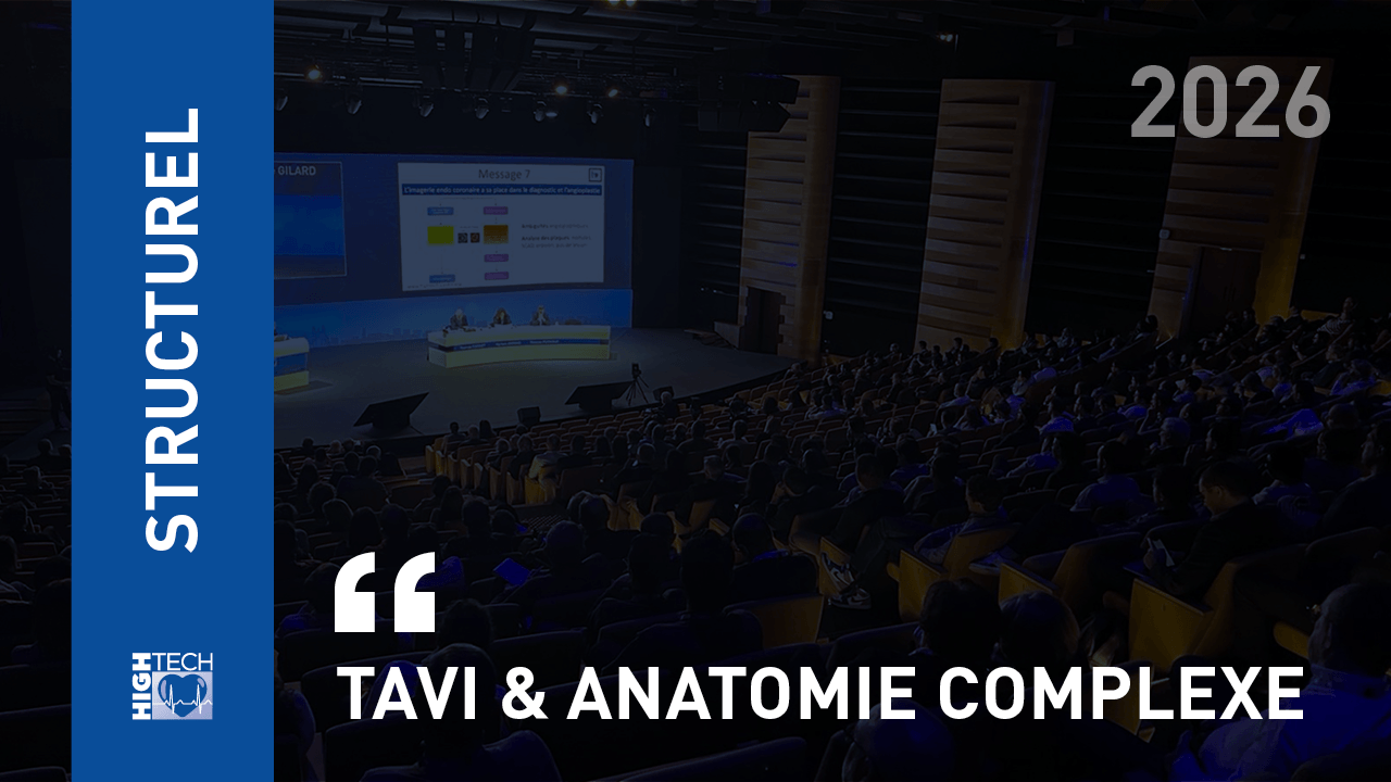 TAVI & anatomie complexe – Kaoutare Chbini