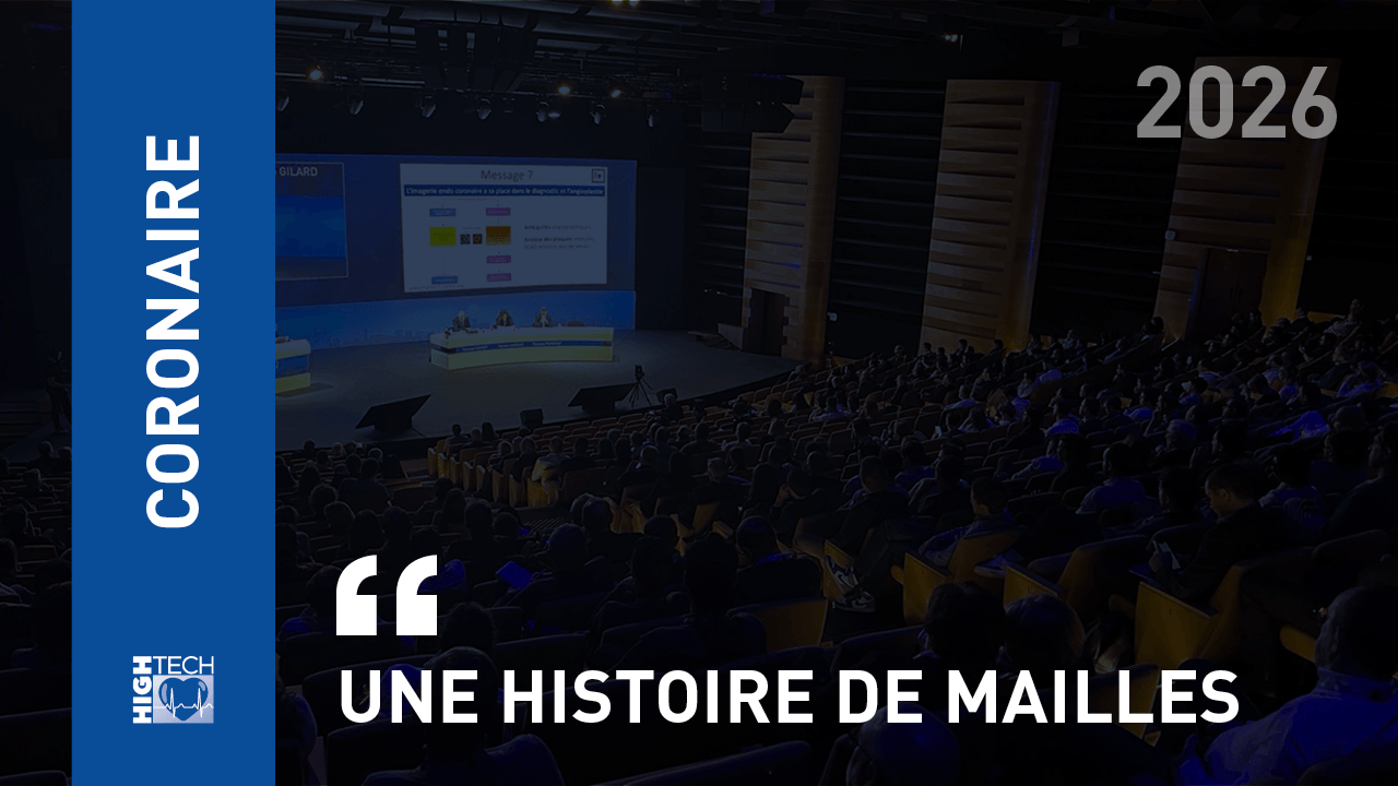 Une histoire de mailles – Simon Berger