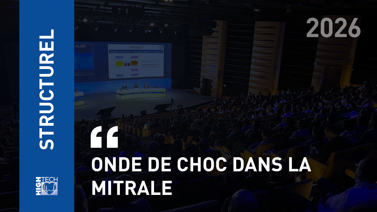 Onde de choc dans la mitrale – Matthieu Bizot